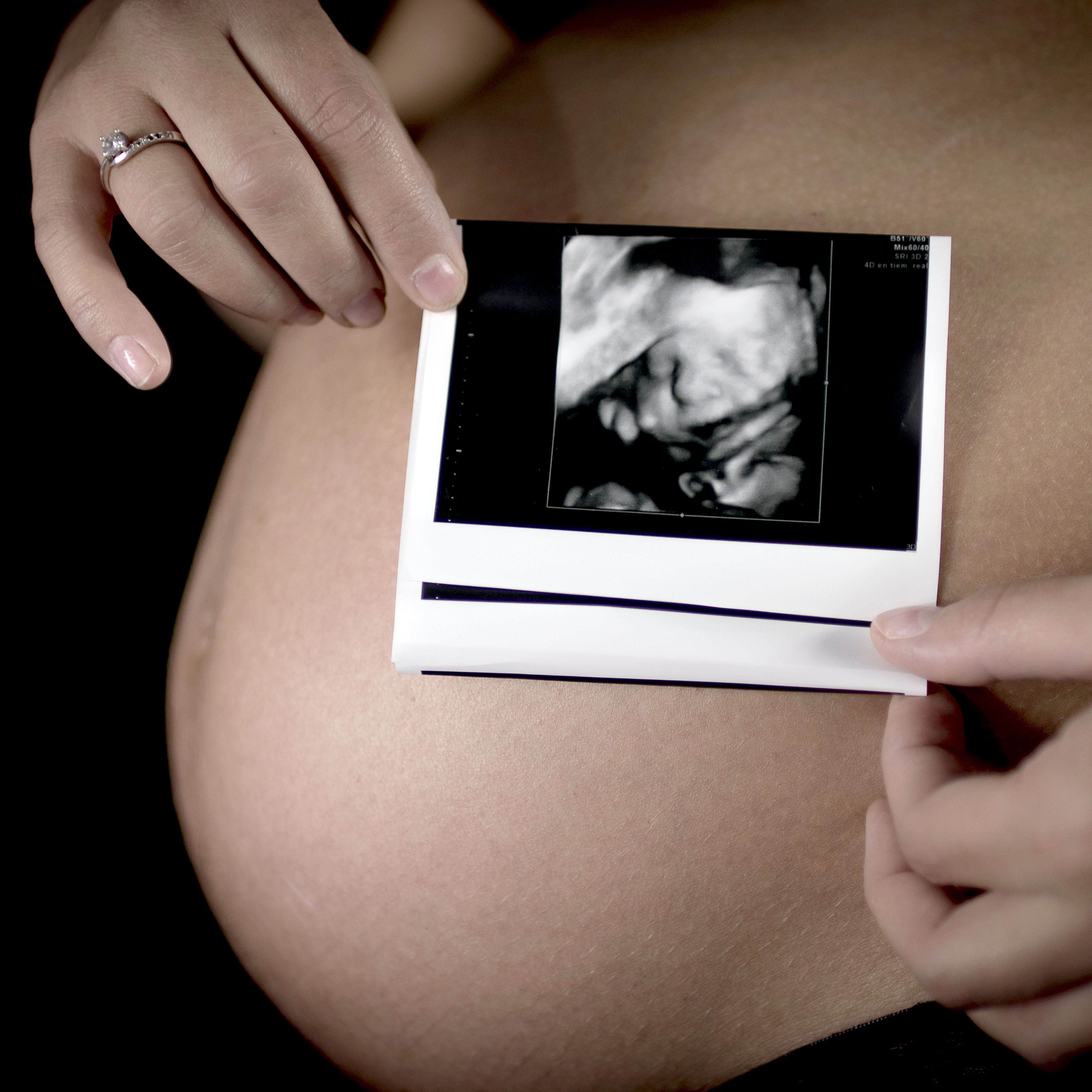 foto familia embarazo